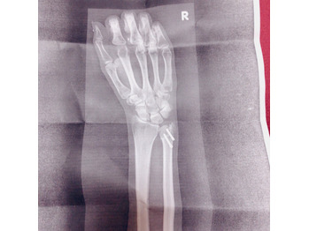 もうすぐ復帰です！！