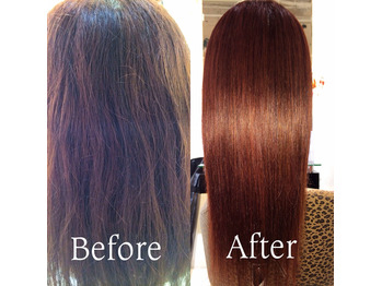 梅雨前に毛髪整形を！