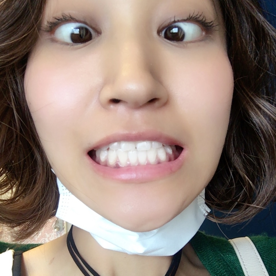 20161018-1 美容師さんは歯が命。ホワイトニング