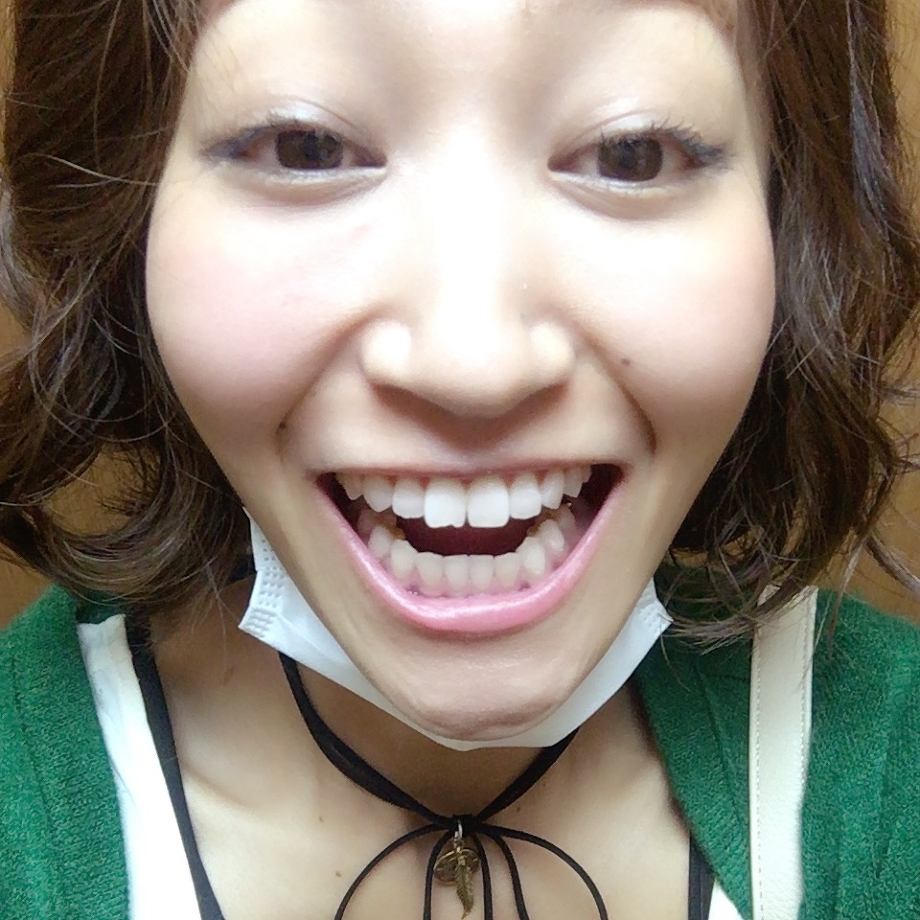 20161018-1 美容師さんは歯が命。ホワイトニング