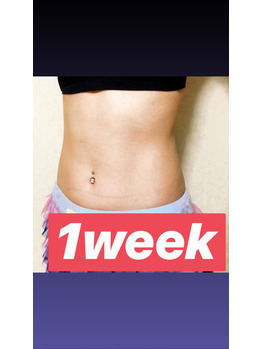 シックスパッド使用のその後