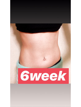 シックスパッド使用のその後